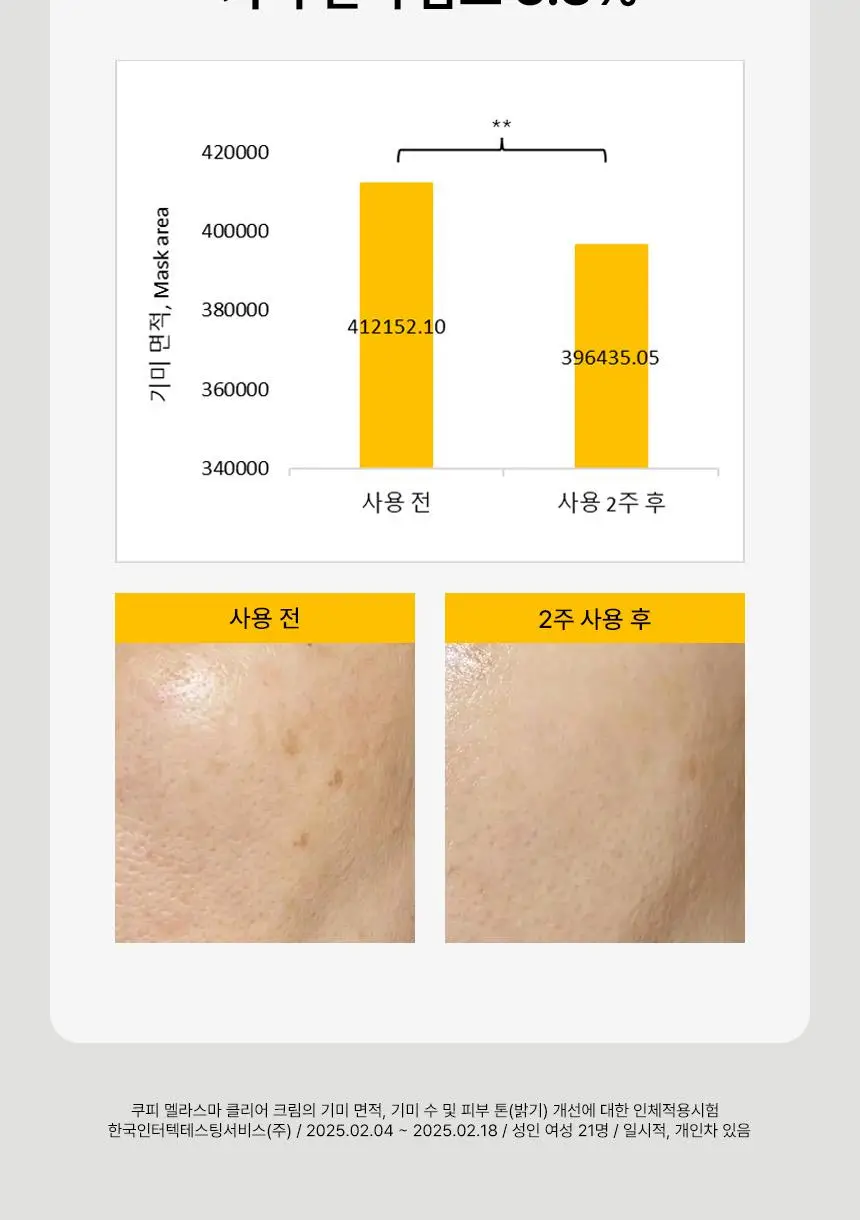 [2주만에기미감소16%] 쿠피 멜라스마 클리어 트라넥삼산 레몬수 기미크림 50ml 상세페이지 15